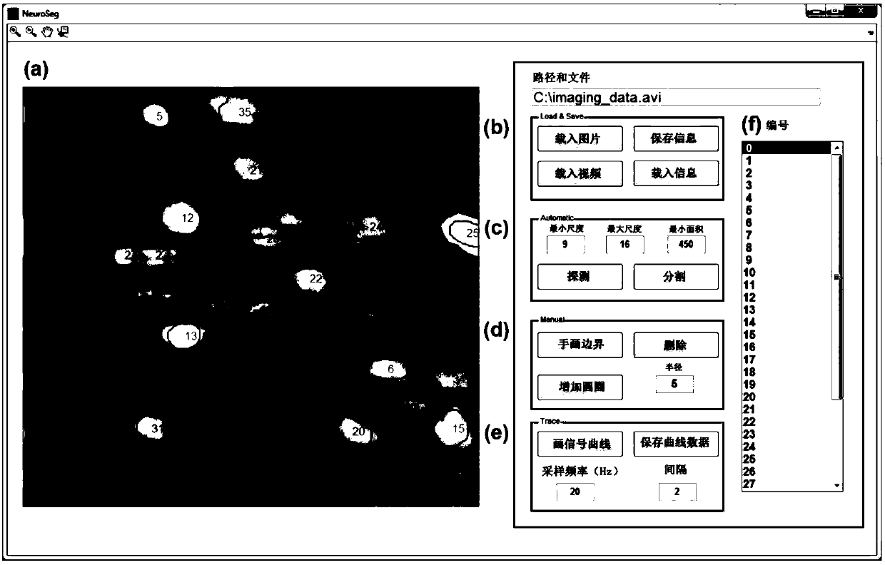 Automatic Detection And Segmentation Method For Cells Based On Two