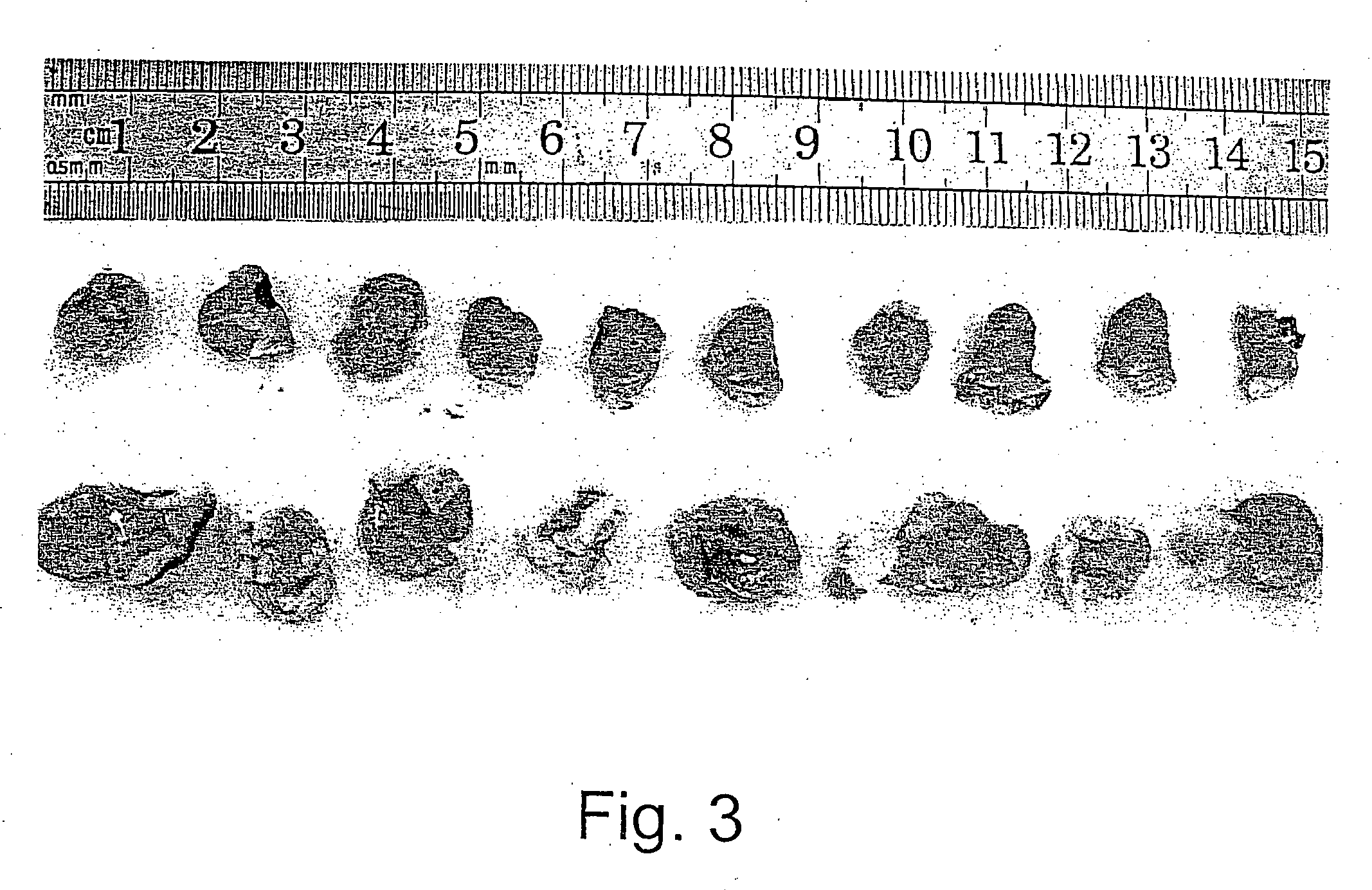 Methods and uses of leptin in immune modulation