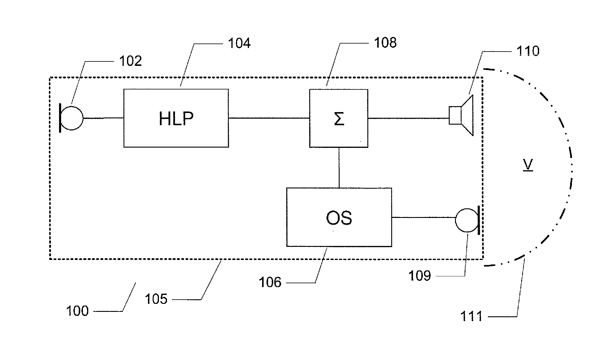 Hearing aid with occlusion suppression