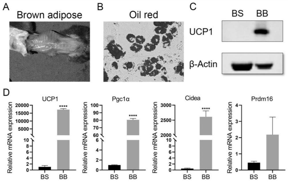 Application of brown adipocyte product in preparation of medicine for preventing and treating osteoporosis
