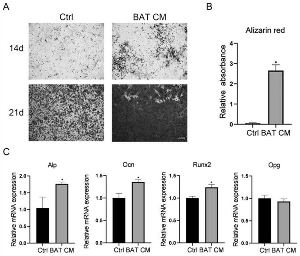 Application of brown adipocyte product in preparation of medicine for preventing and treating osteoporosis