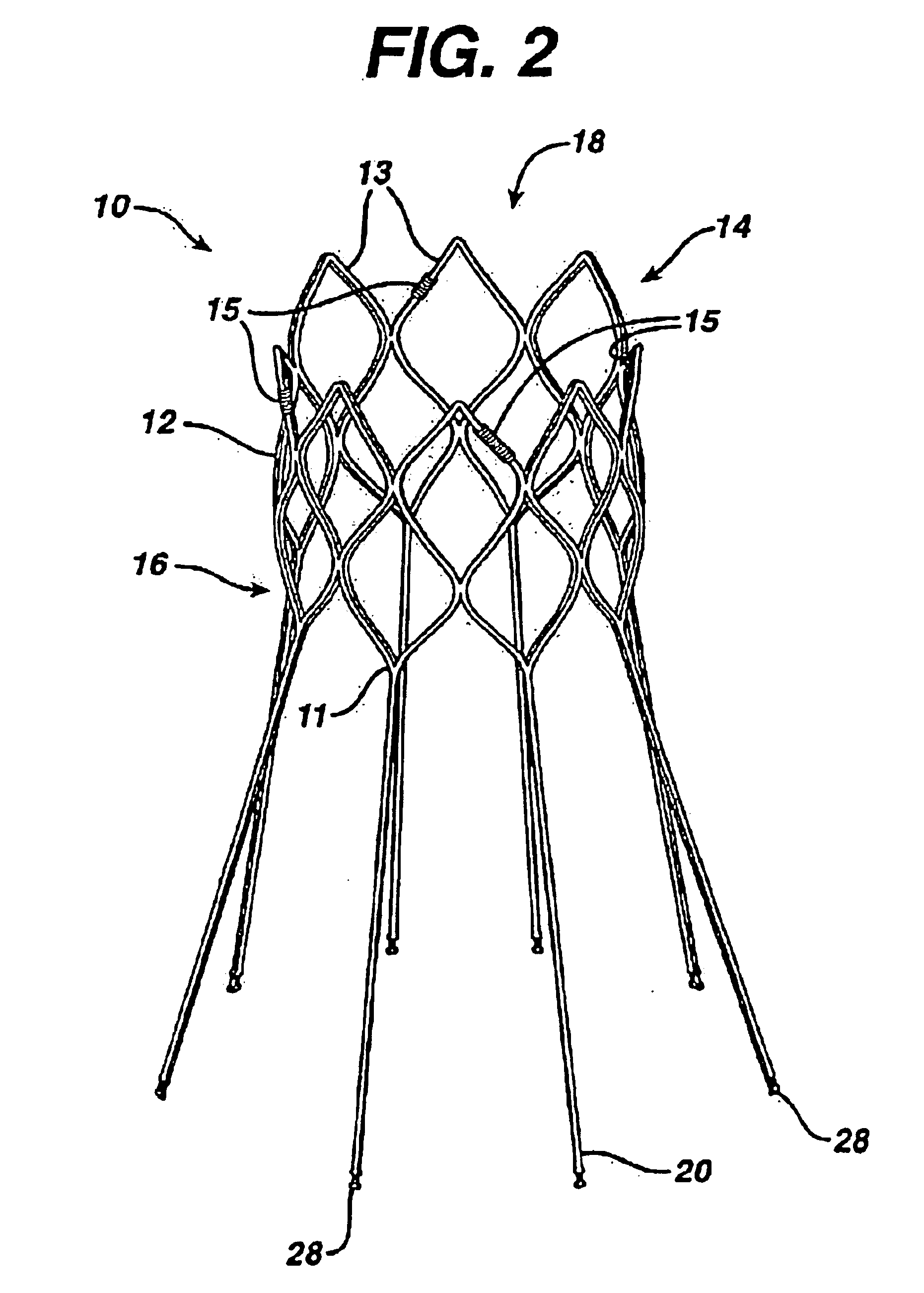 Extension prosthesis for an arterial repair