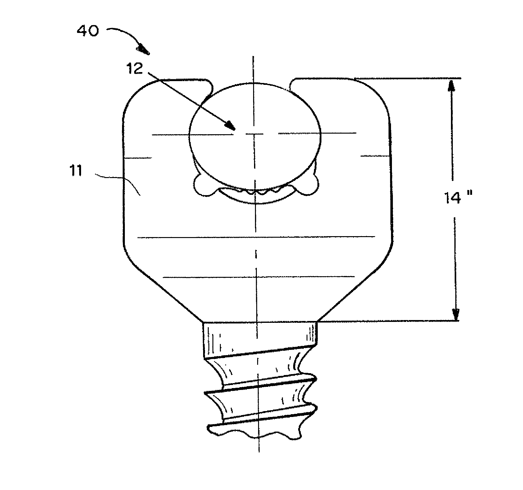 Shape memory locking device for orthopedic implants