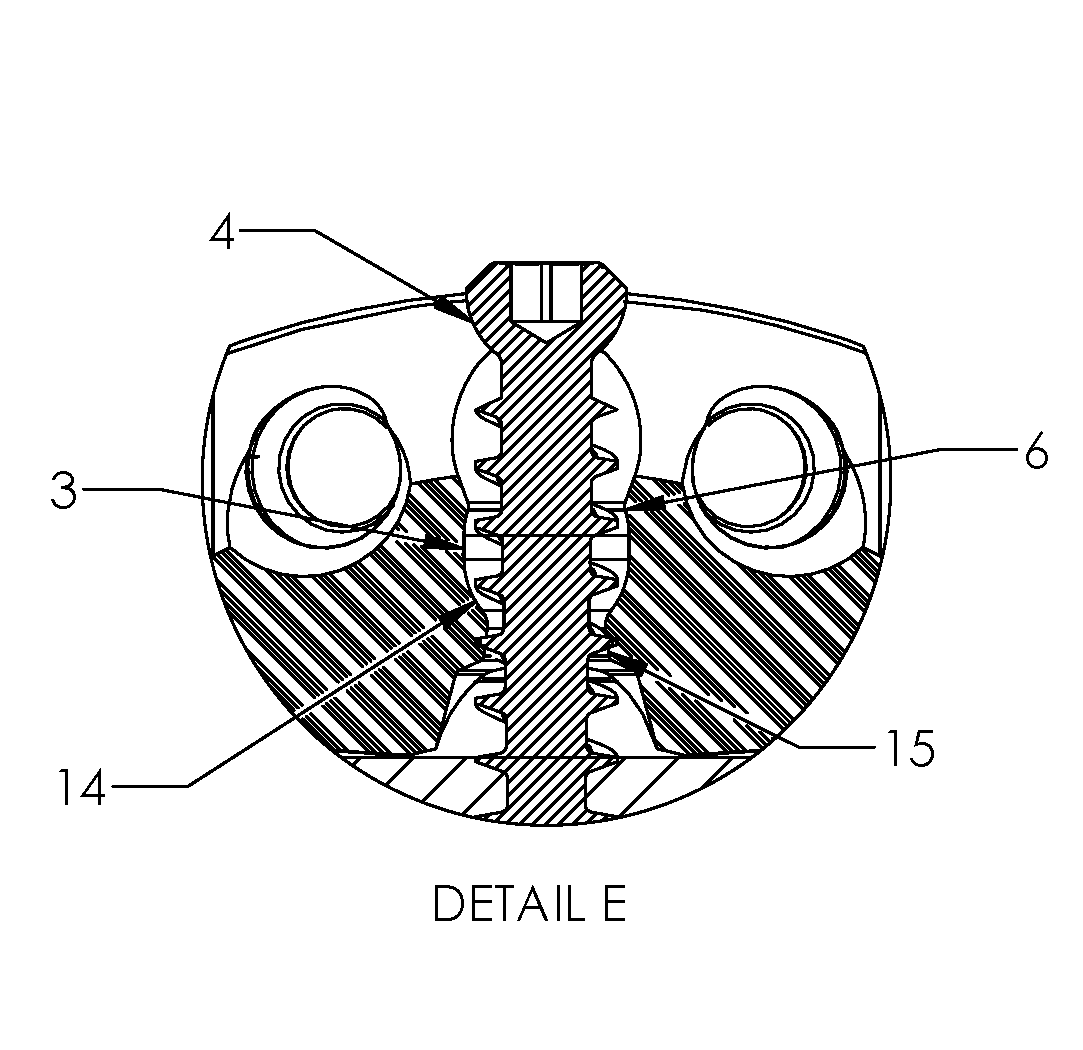 Spinal Implant with Screw Retention and Removal Mechanisms