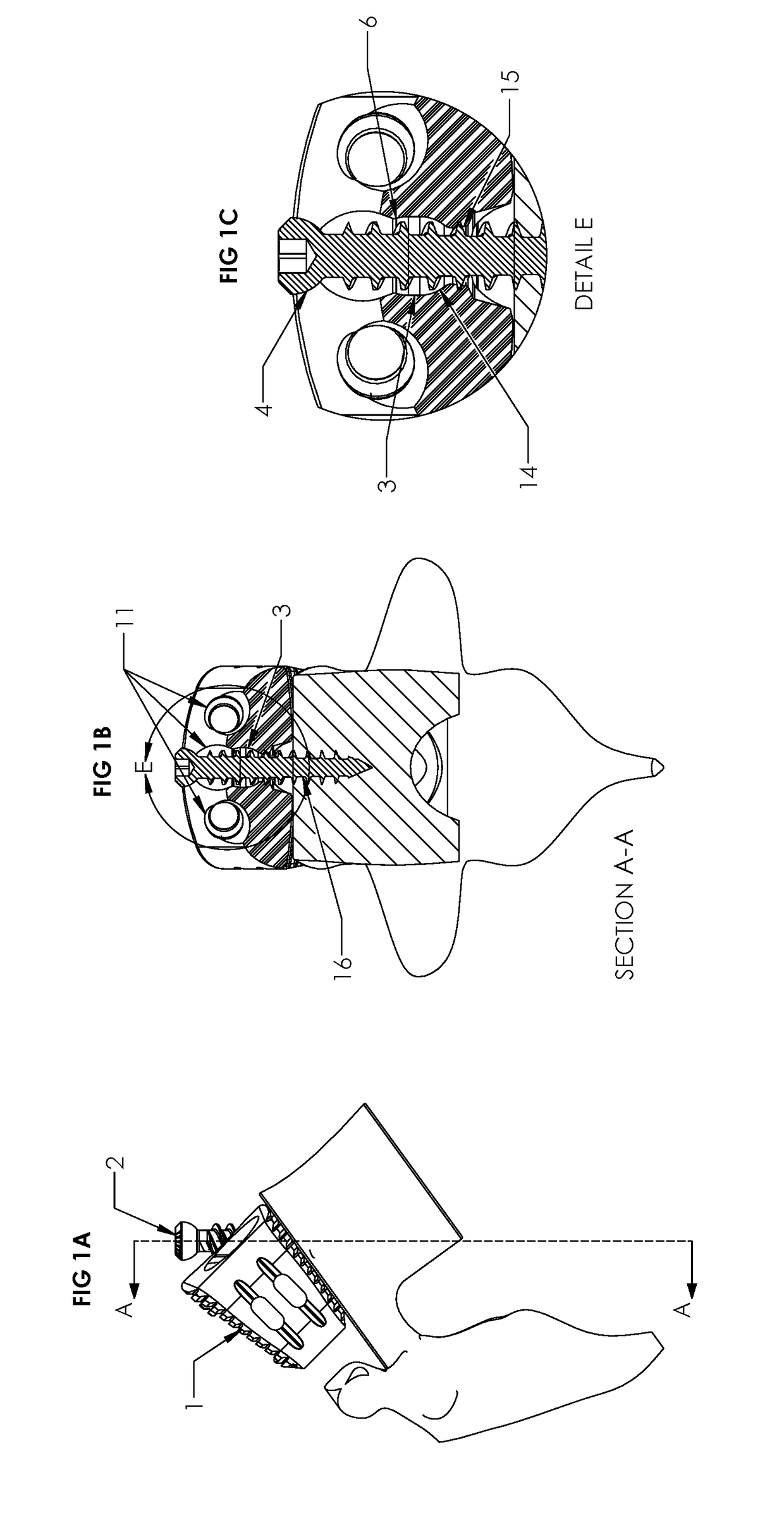 Spinal Implant with Screw Retention and Removal Mechanisms