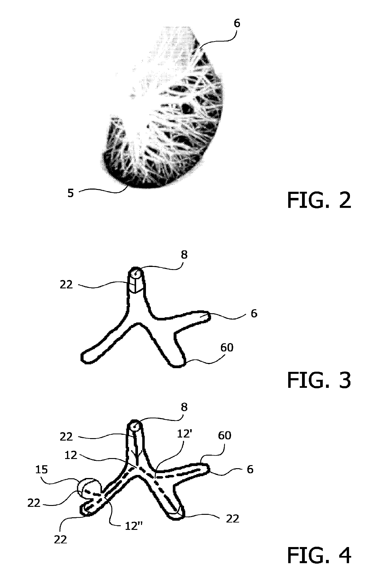 Identifying abnormal tissue in images of computed tomography