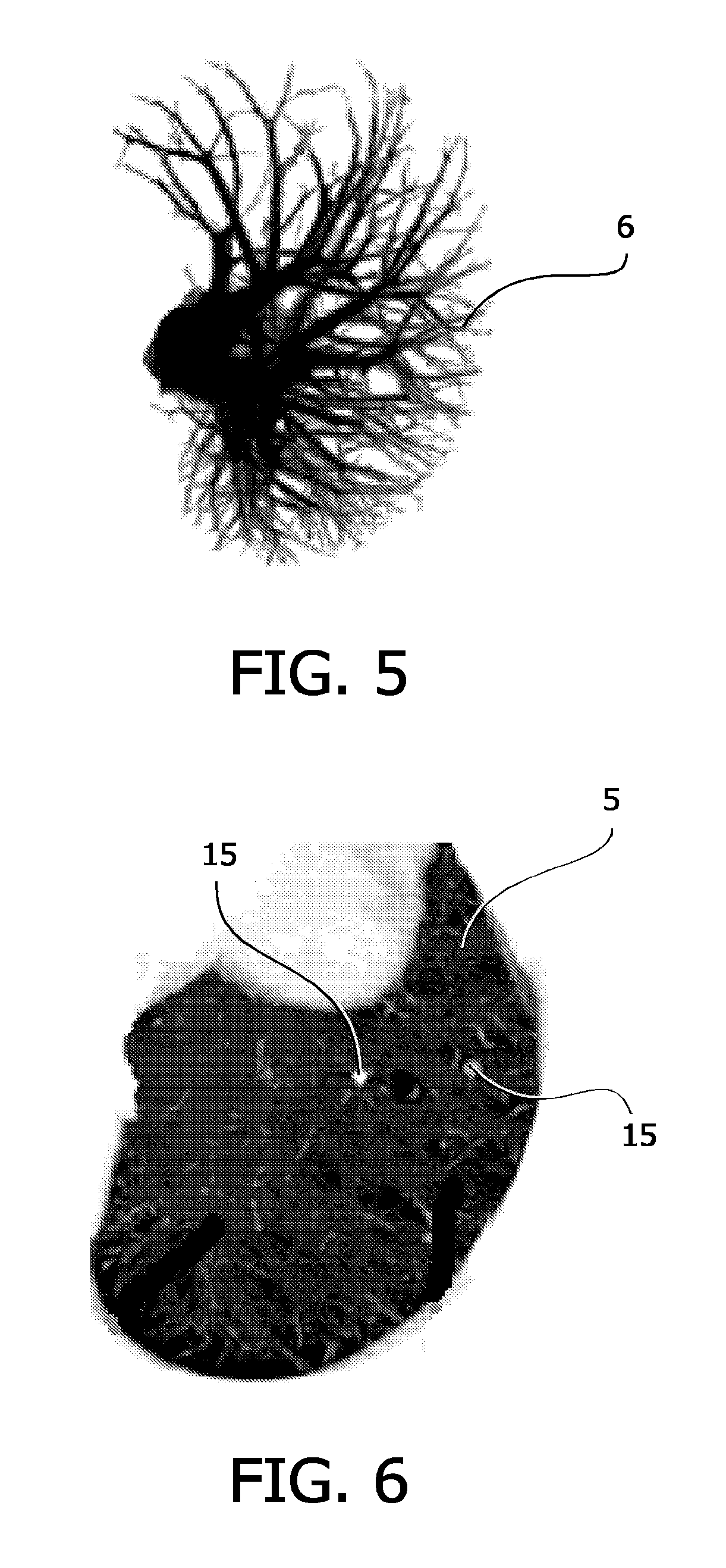 Identifying abnormal tissue in images of computed tomography