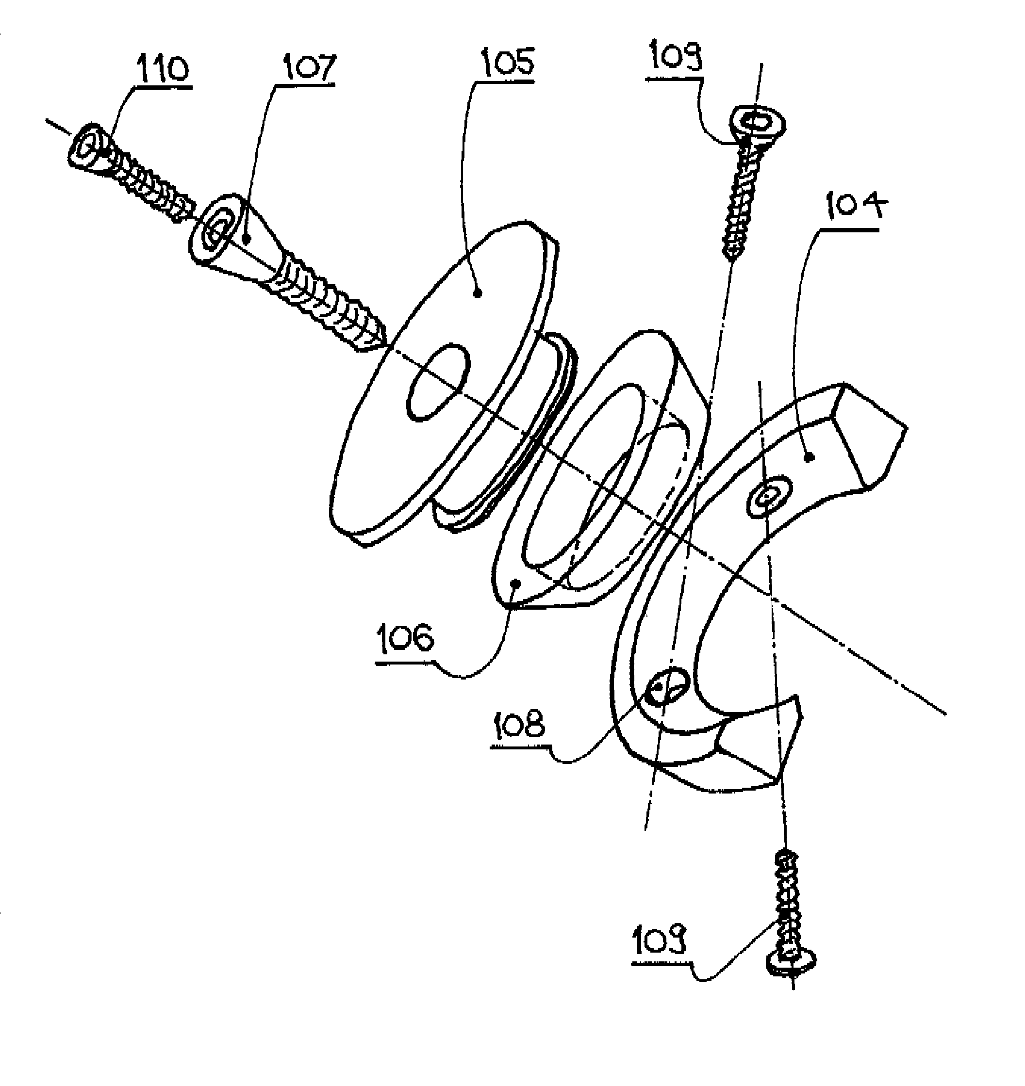 Elbow joint prosthesis and method for implantation