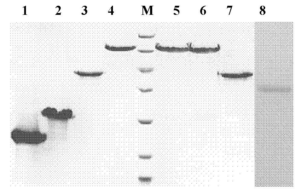 Recombinant beta-amyloid peptide B cell epitope polypeptide chimeric antigen and preparation method and application thereof