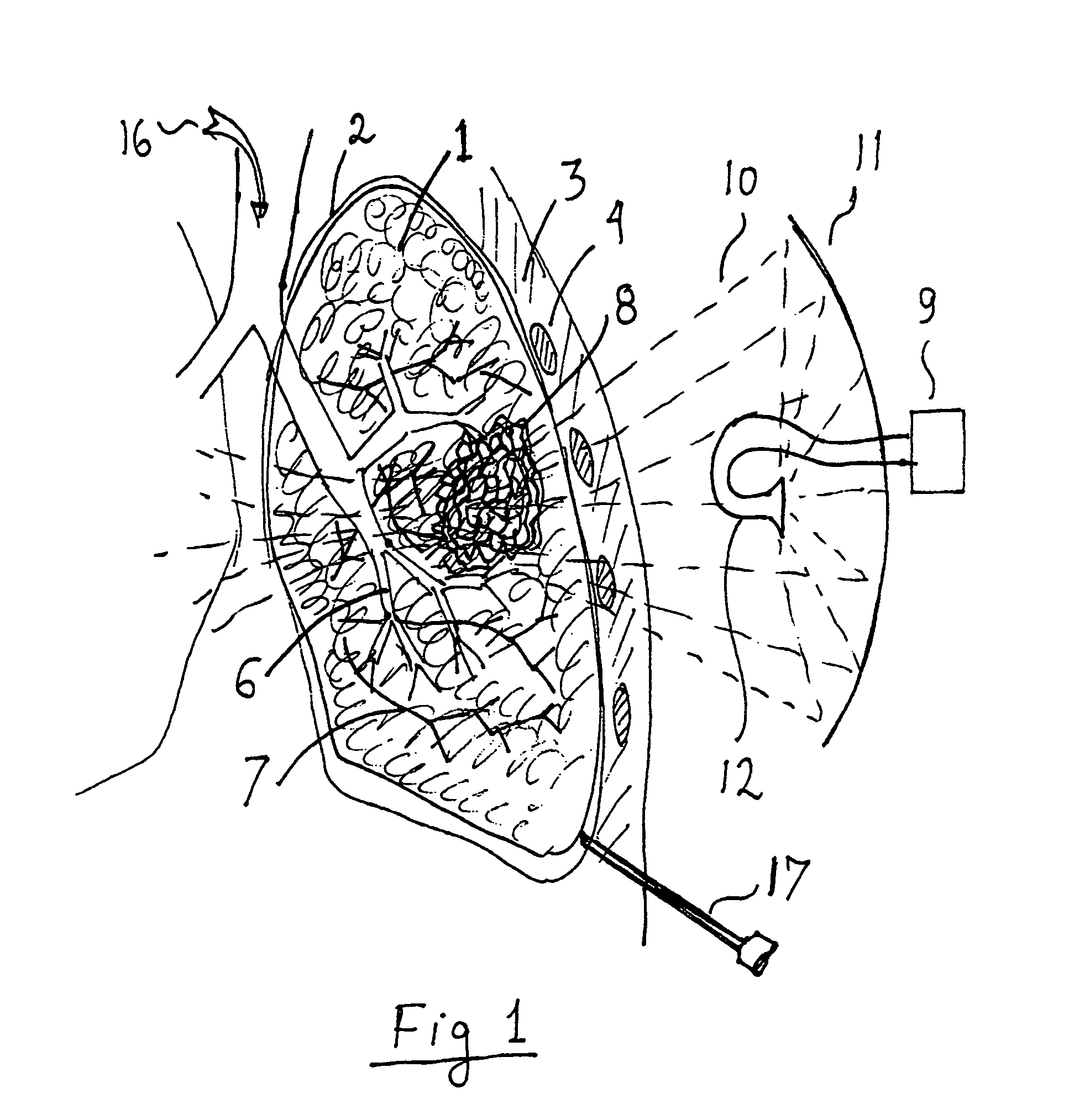 Methods for selectively heating tissue