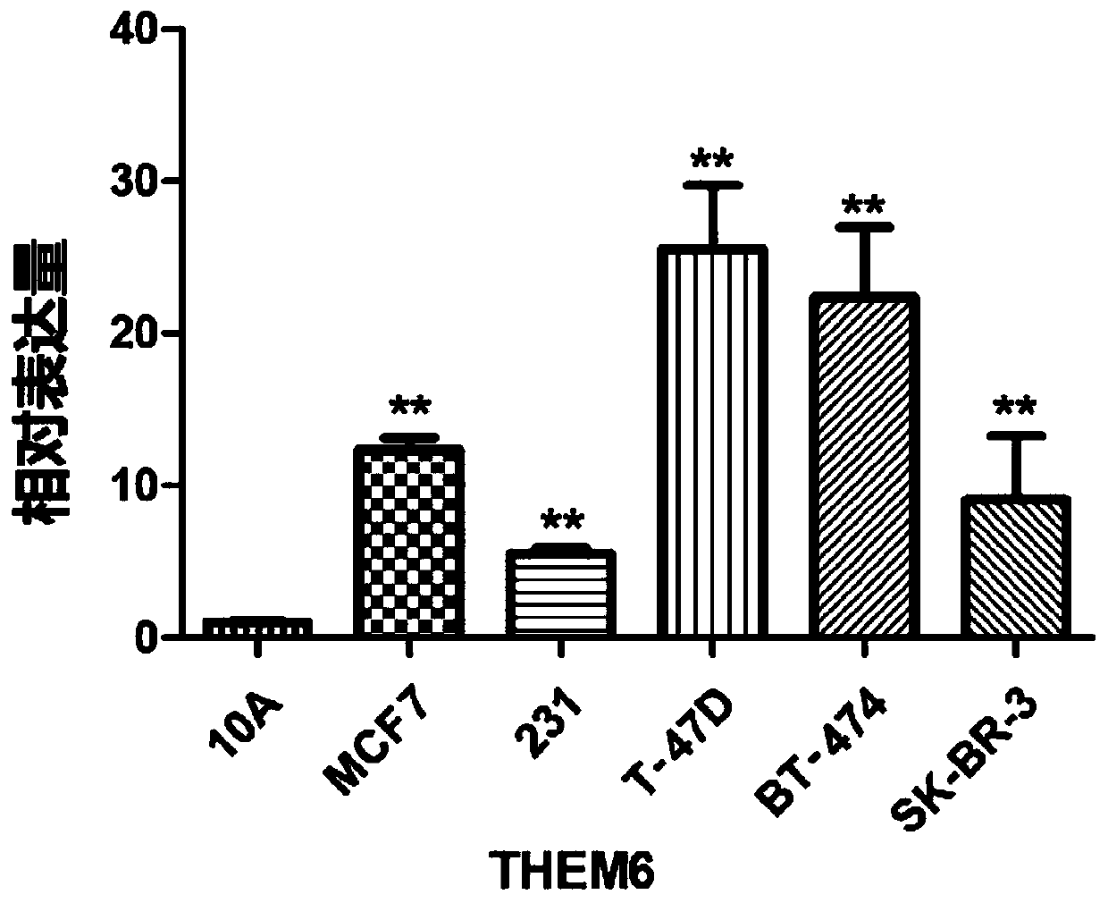 siRNA for reducing expression of THEM6 gene, recombinant vector and application thereof