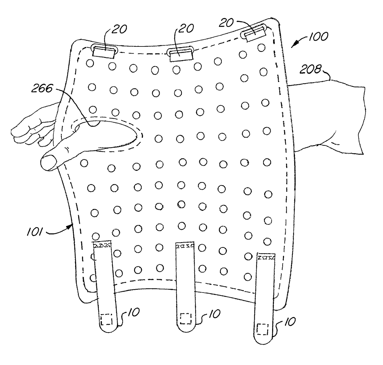 Self-Fitting, Self-Adjusting, Automatically Adjusting and/or Automatically Fitting Orthopedic or other (e.g. non human use) Immobilization Splint or Device