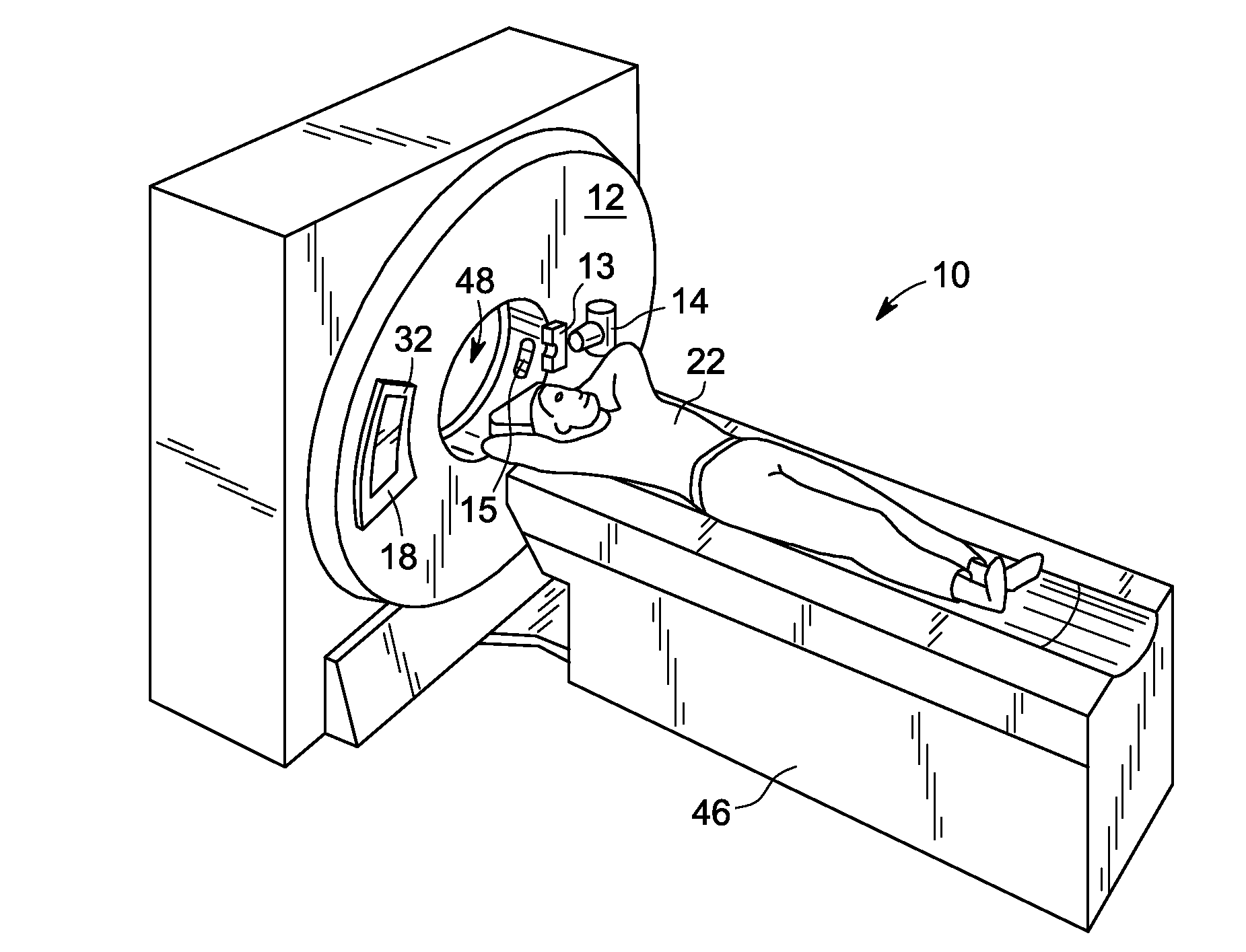 System and method of notch filtration for dual energy ct