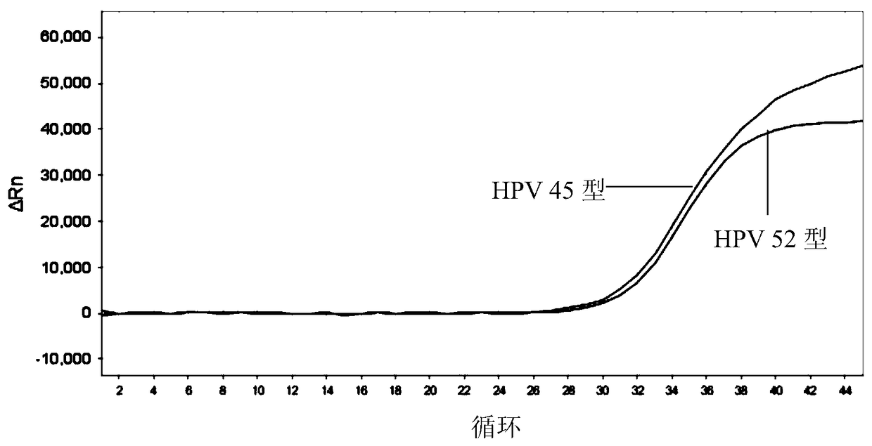 Nucleic acid detection kit for human papillomavirus and method and application thereof