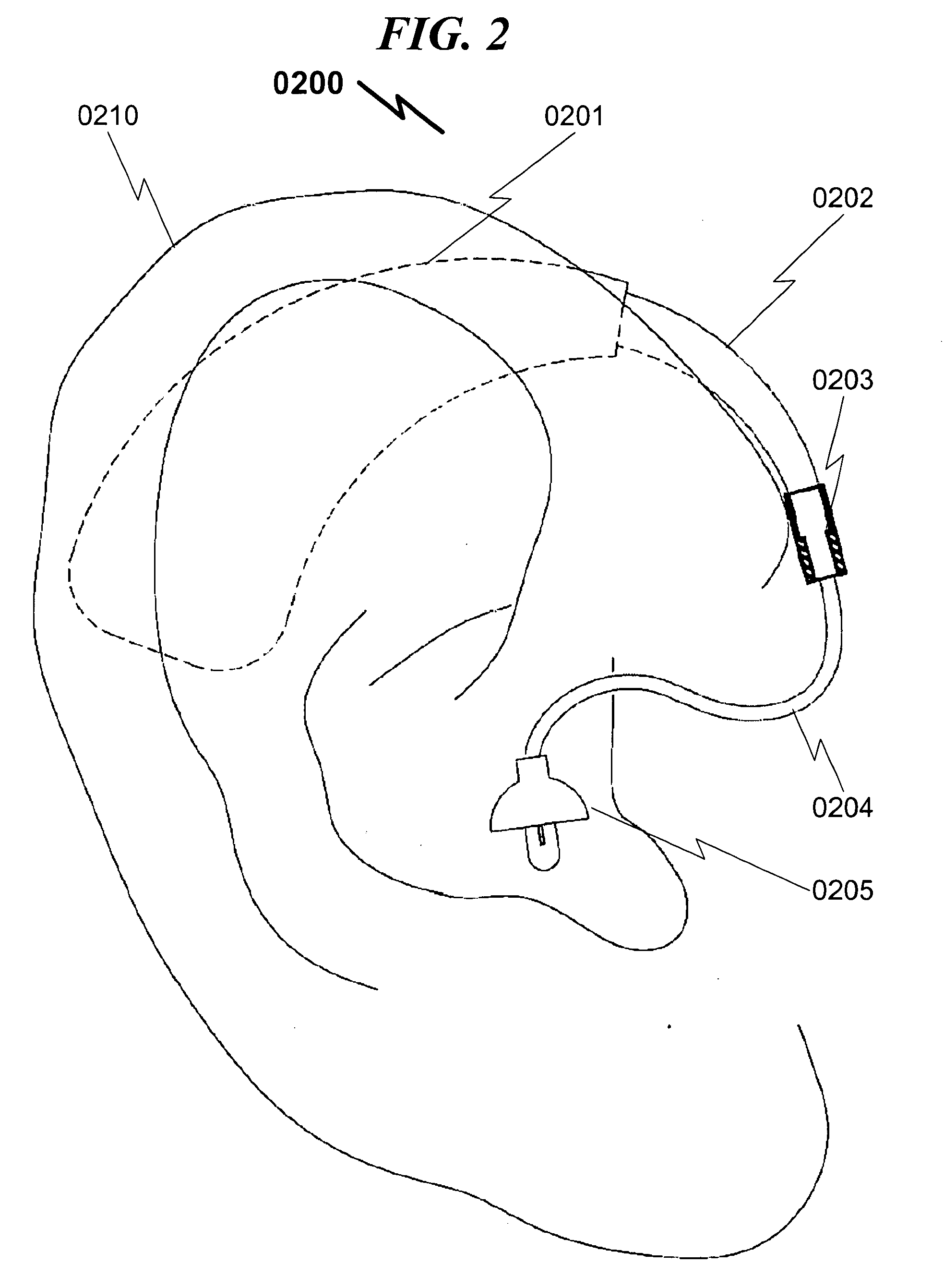 Hearing aid eartip coupler system and method