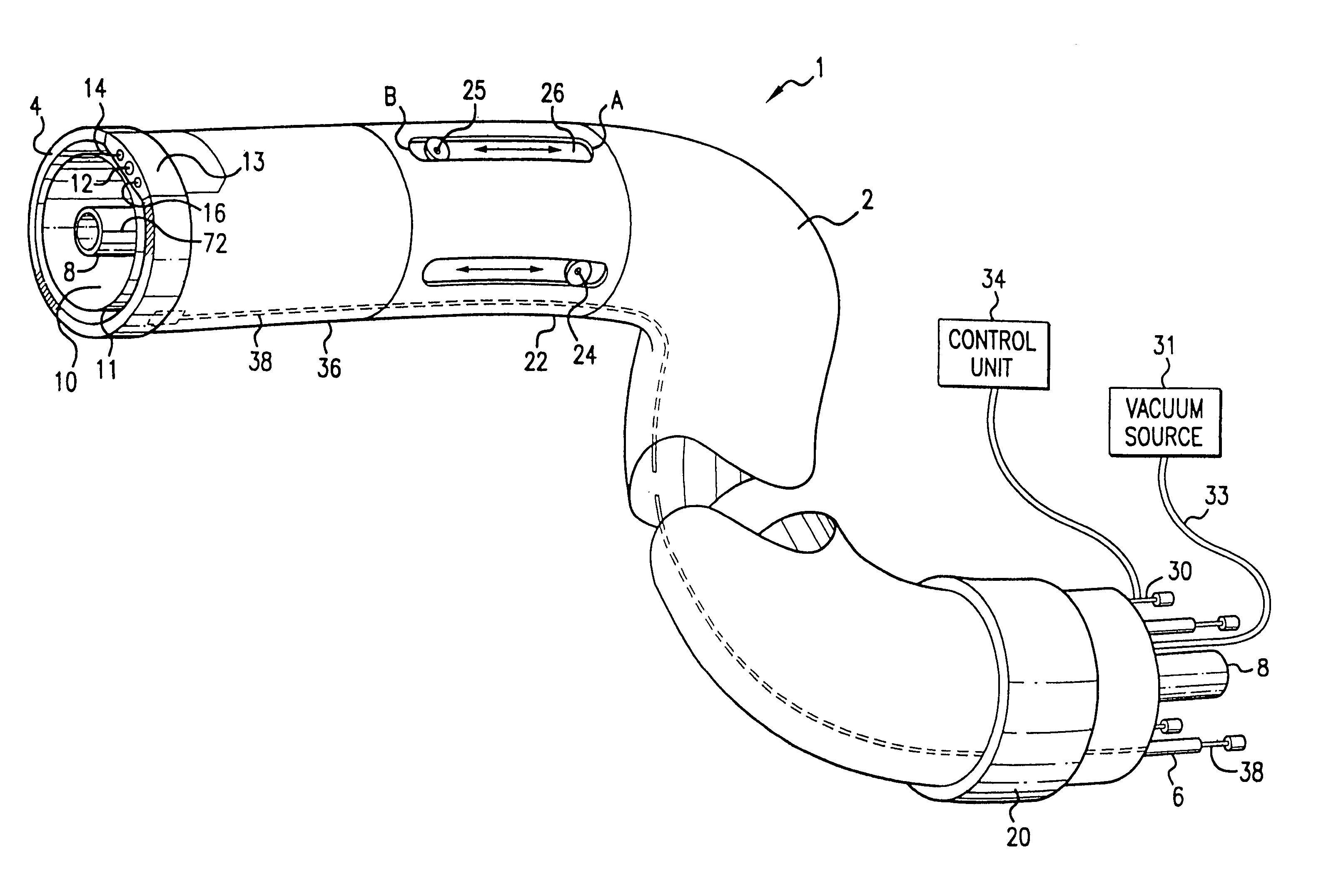 Catheter introducer system for exploration of body cavities