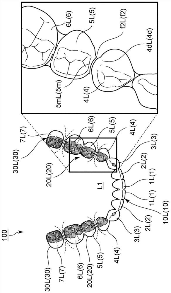 PARTIALLY CONNECTED COMPLETIVE ARTIFICIAL TOOTH HAVING ADJUSTMENT OF dental arch and occlusion bend