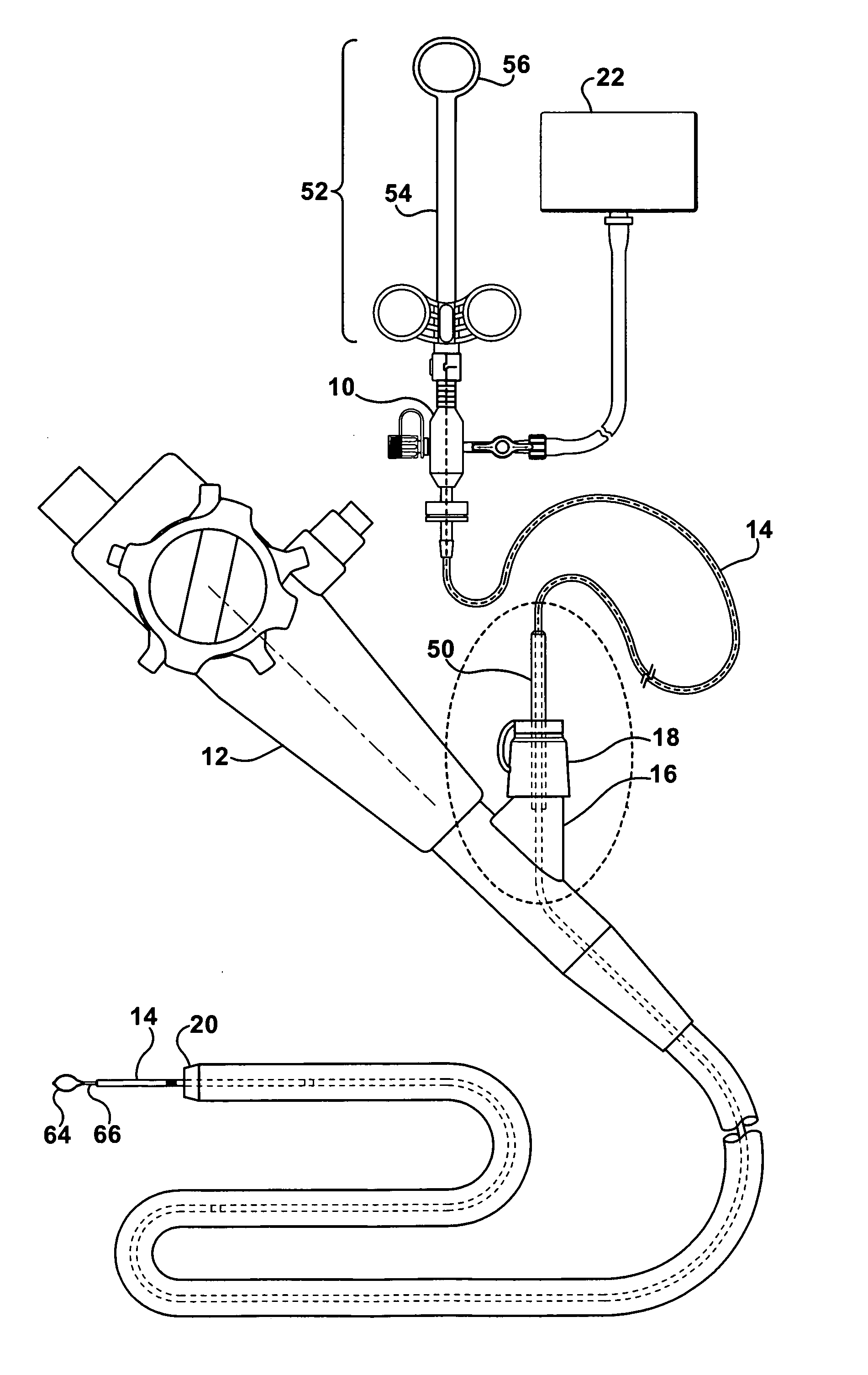Polypectomy device and method of use