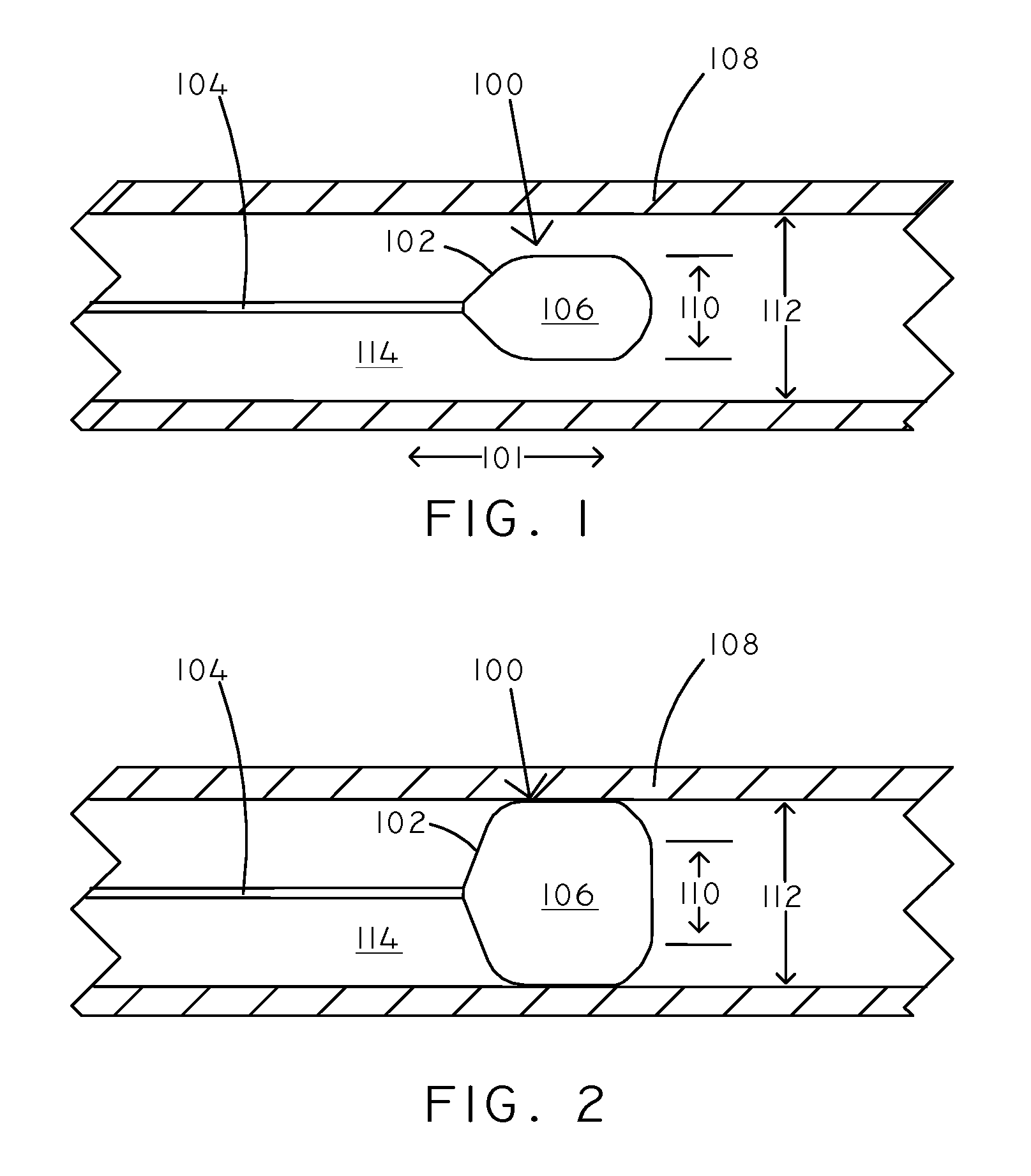 Osmotic Devices and Methods for Diuretic Therapy