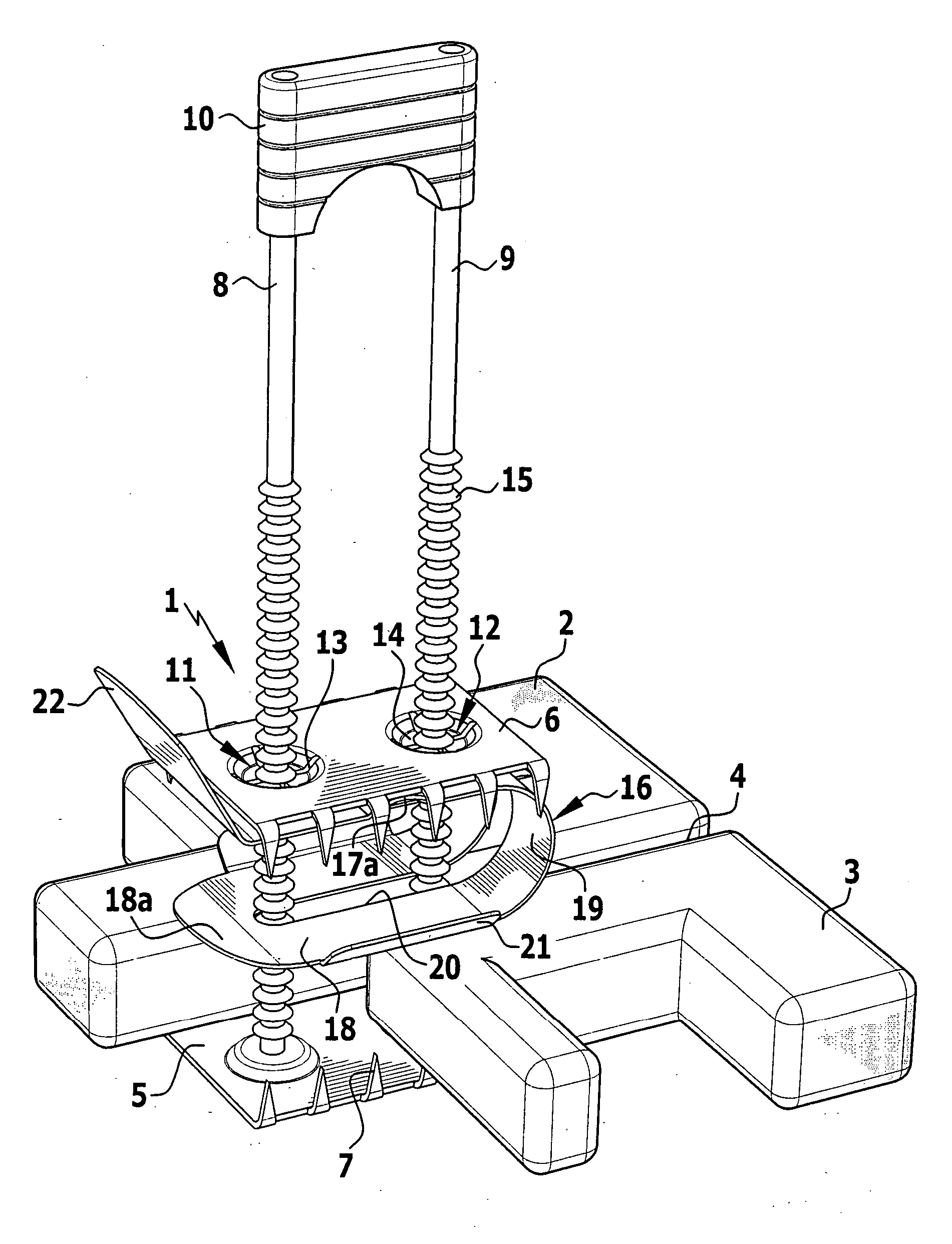 Surgical fixing device for two bone parts