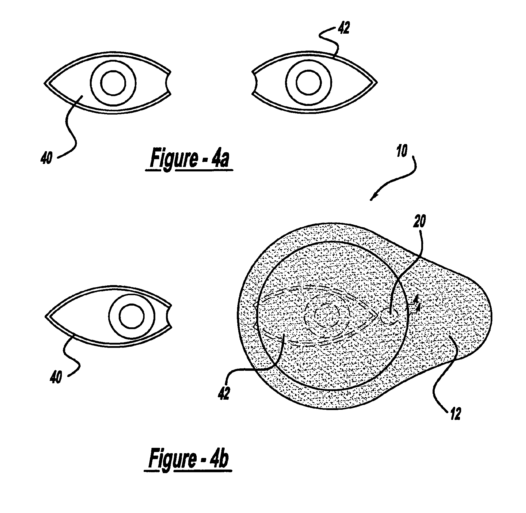LED fixation device for topical anesthesia eye surgery
