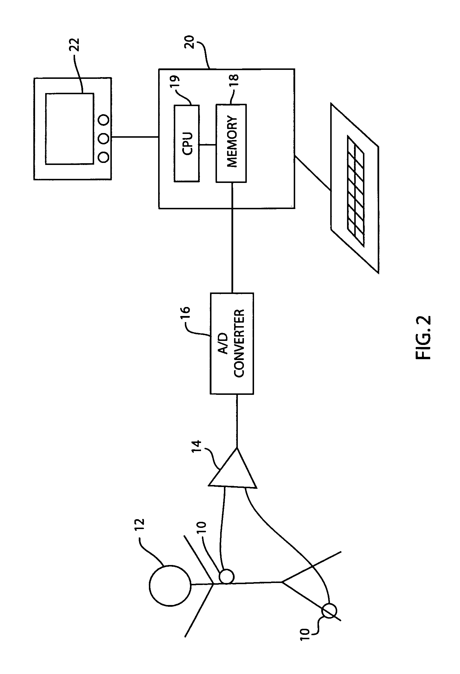 Method and apparatus for analyzing and editing ECG morphology and time series