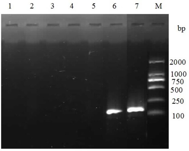 Pigeon ttv and pigeon new adenovirus double Evagreen real-time fluorescent quantitative PCR detection kit