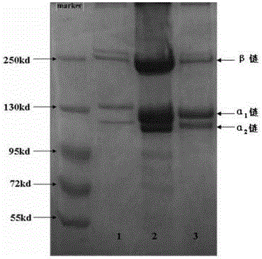 Preparation method of pepsin-soluble high-purity superhelical-structured type-I collagen
