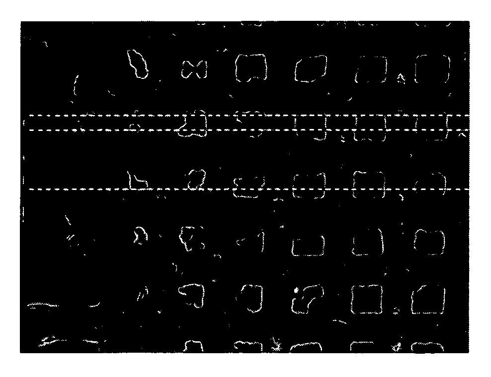 Transdermal delivery system for dried particulate or lyophilized medications