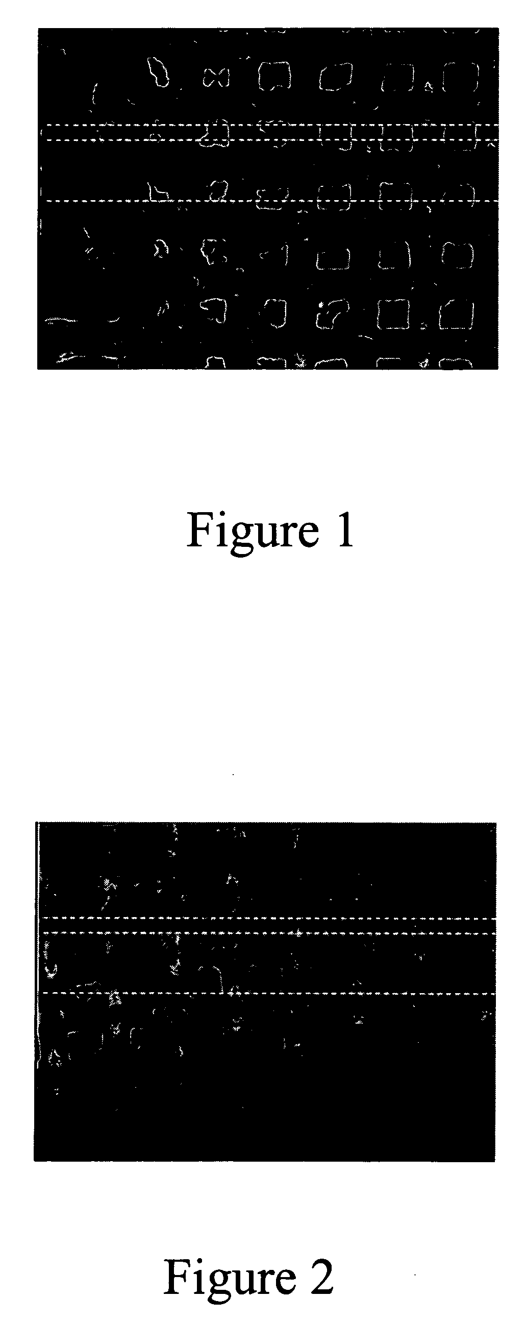 Transdermal delivery system for dried particulate or lyophilized medications