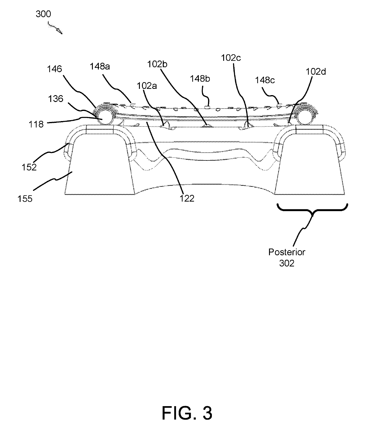 Force damping dental bridge assembly with synthetic periodontal ligament fibers