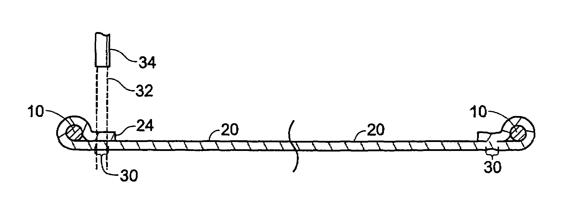 Method for suturelessly attaching a biomaterial to an implantable bioprosthesis frame