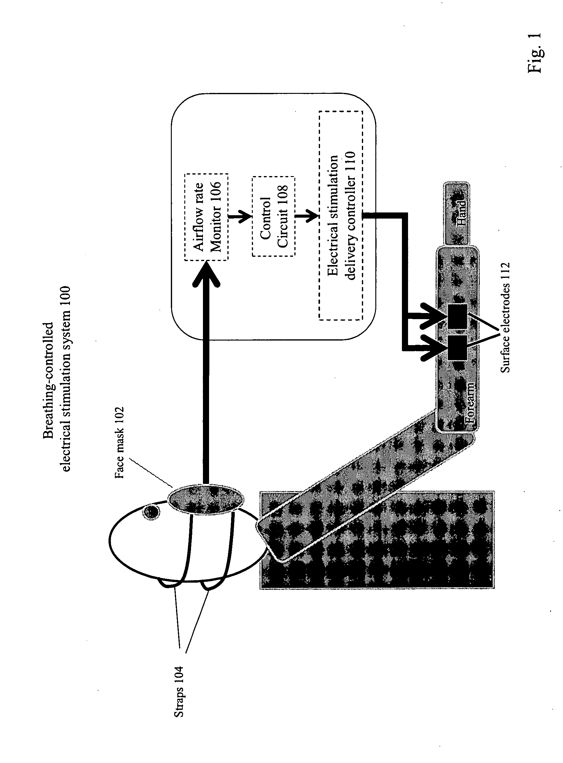 Method and Apparatus of Breathing-Controlled Electrical Stimulation for Skeletal Muscles