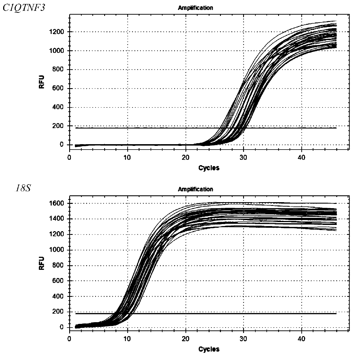 Primer, kit and detection method for detecting C1QTNF3 gene 219bp-deletion variable spliceosome
