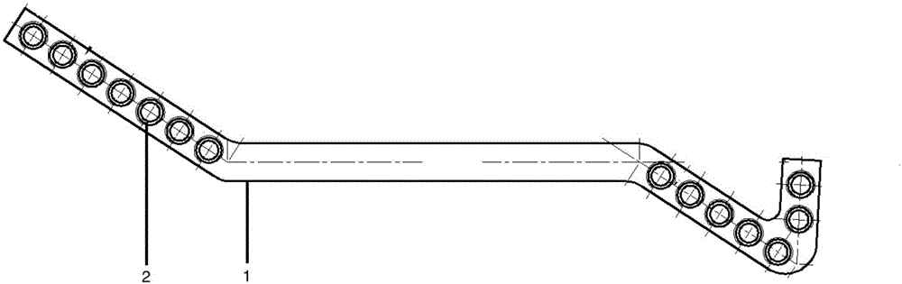 Locking external fixator for clavicle fracture treatment