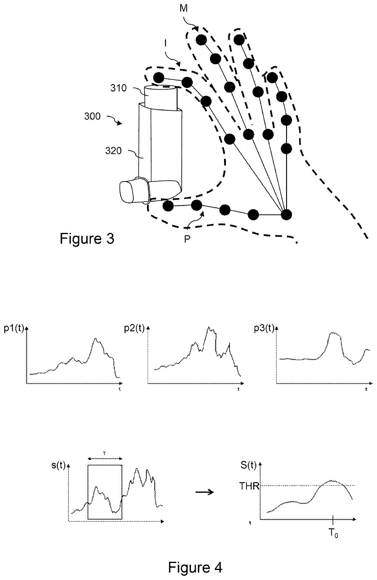 Detection of the synchronization between the actuation of a metered-dose inhaler and a patient's inspiration