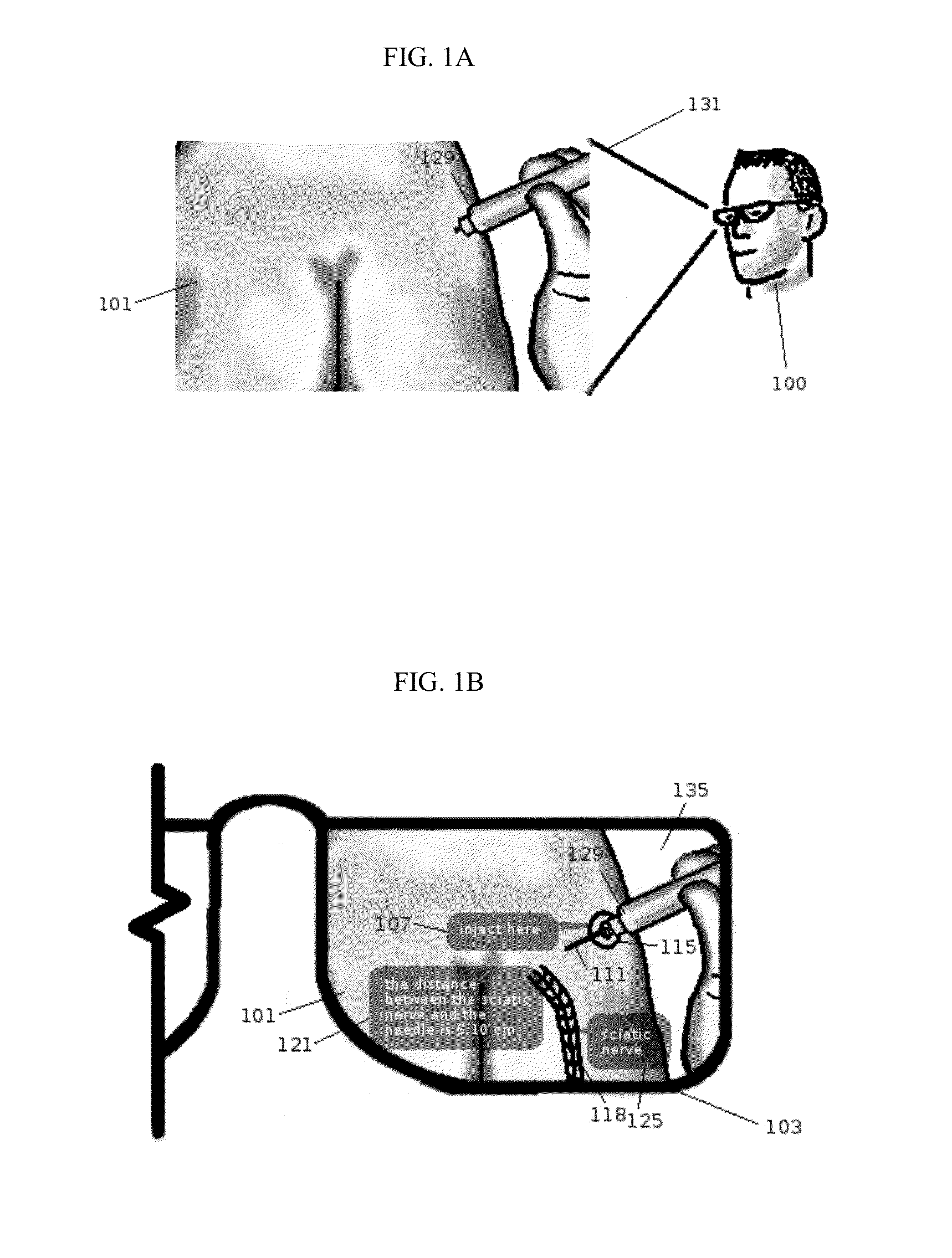 Method and system of displaying information during a medical procedure