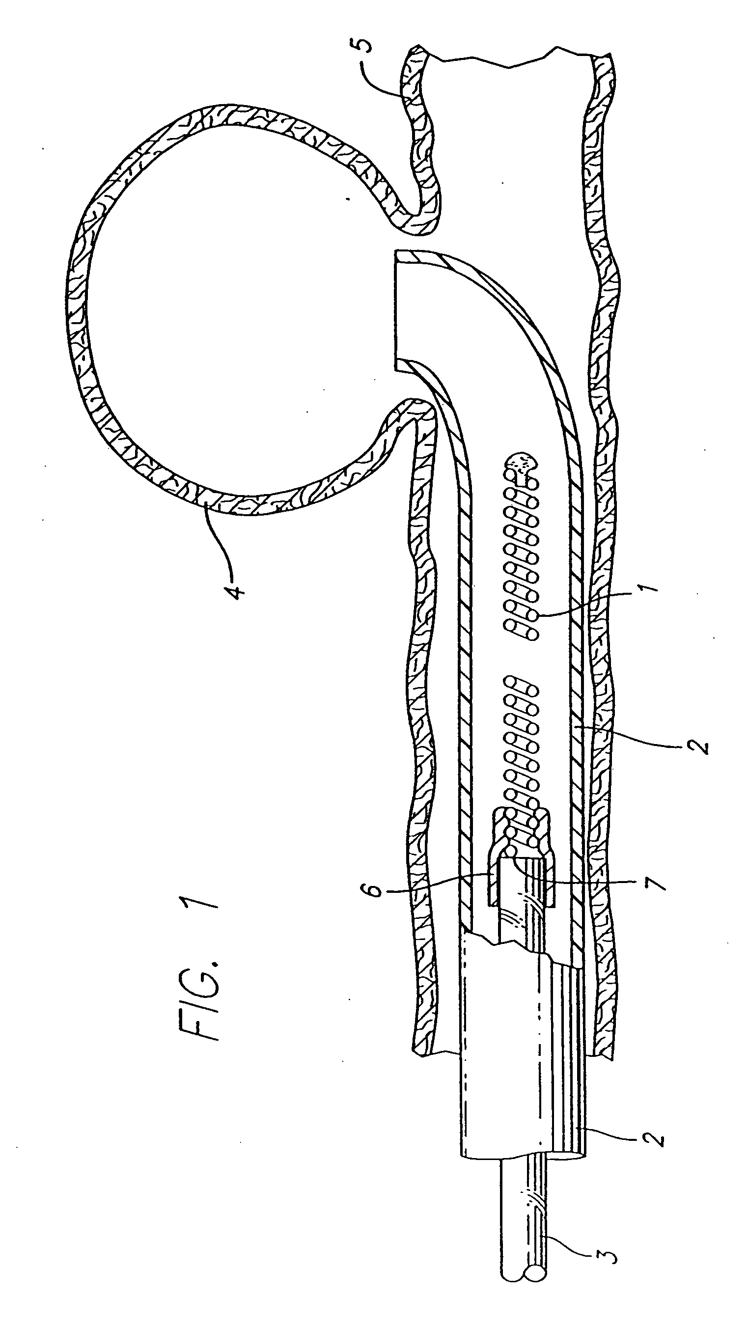 Three dimensional, low friction vasoocclusive coil, and method of manufacture