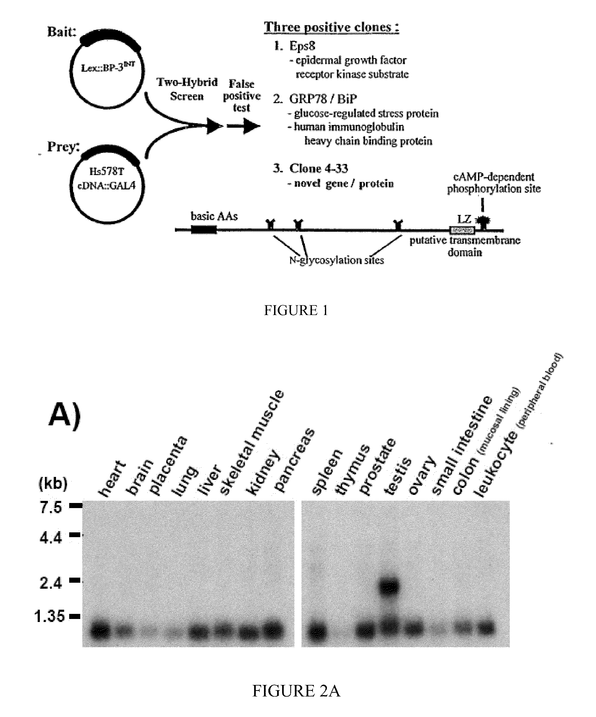 Induction of apoptosis and cell growth inhibition by protein 4.33