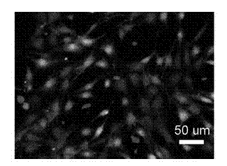 Preparation method of glycopeptide hydrogel containing glucosamine unit and application of glycopeptide hydrogel in preparing postoperation scar inhibitor
