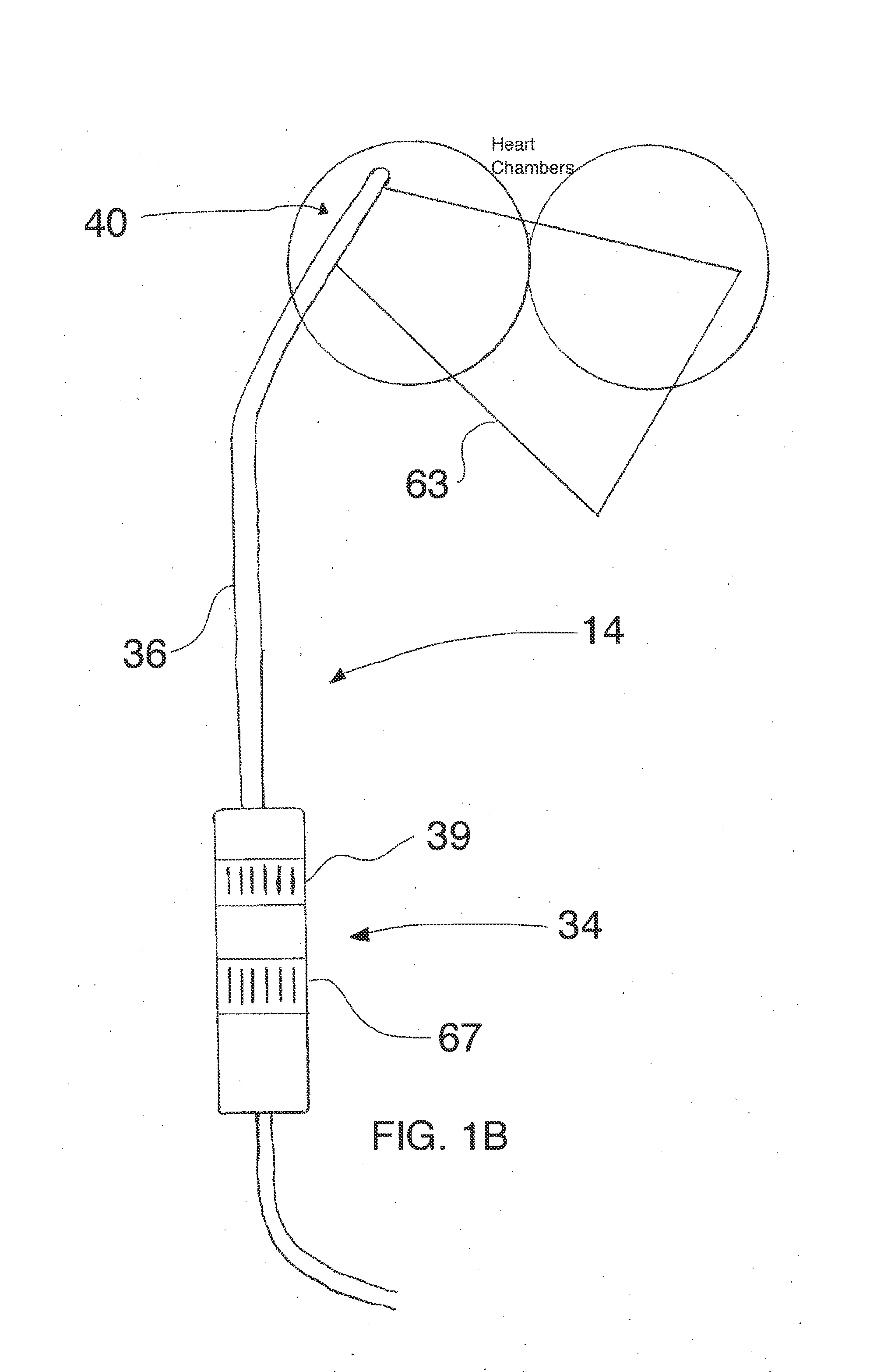 Device, system, and method for intracardiac diagnosis or therapy with localization