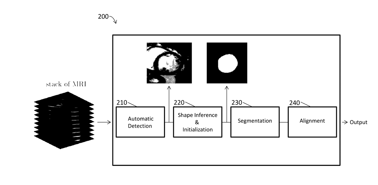 Automated segmentation of organ chambers using deep learning methods from medical imaging
