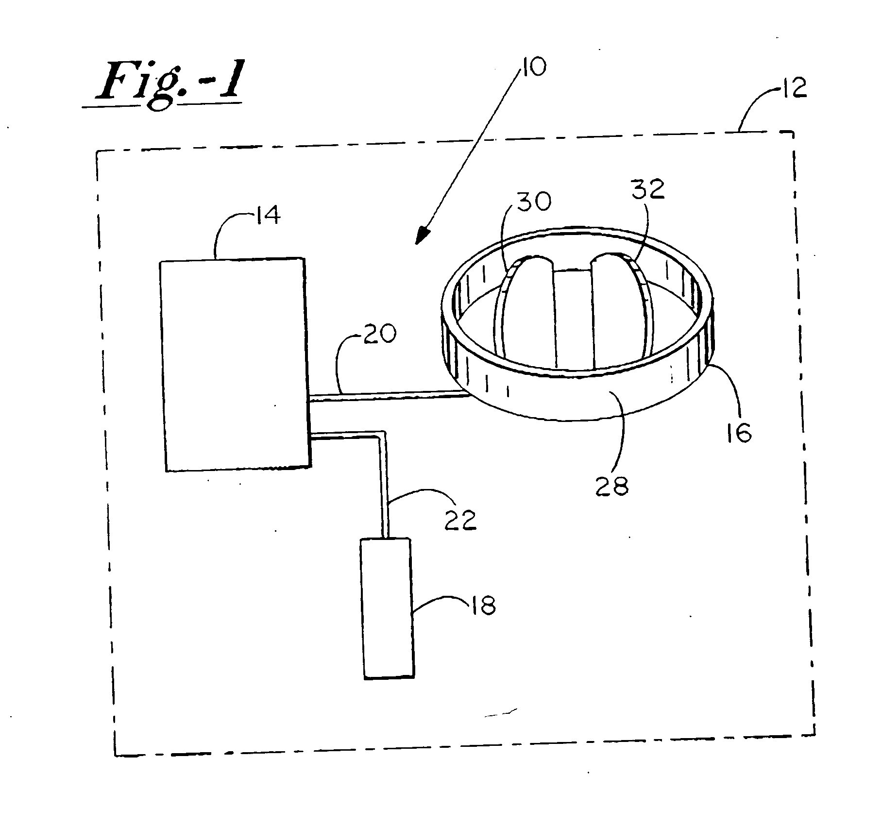 System for conditioning surfaces in vivo