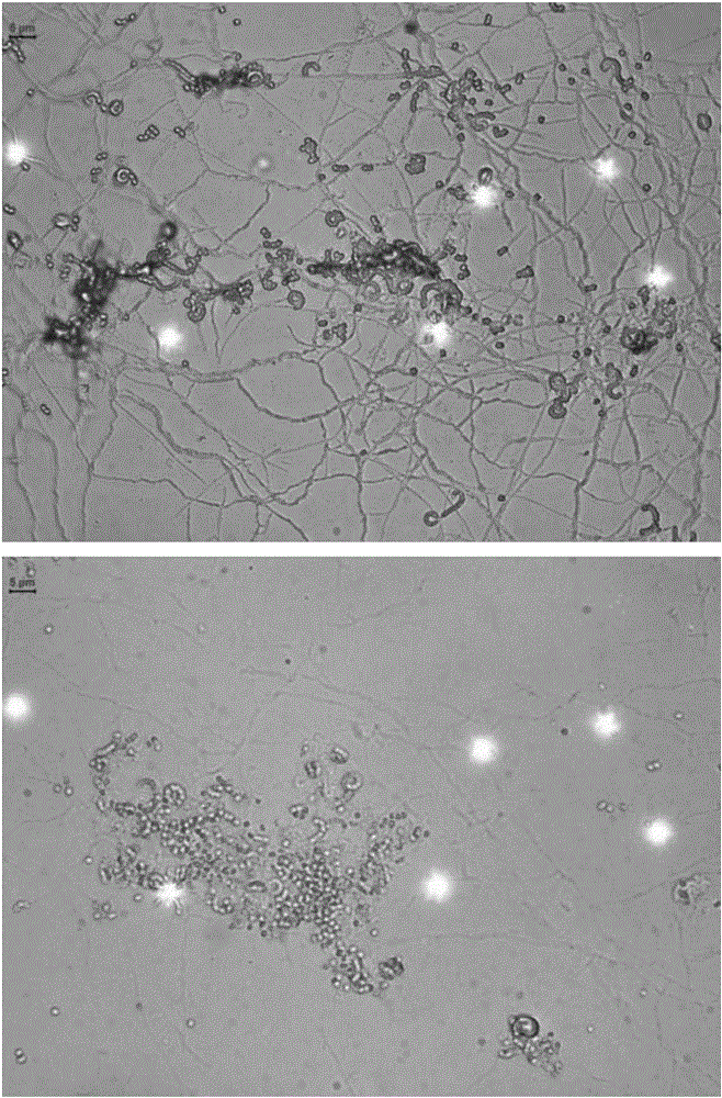 Streptomyces malaysiensis and application thereof