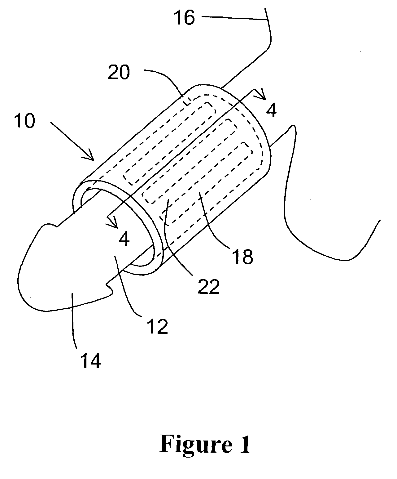 Urinary incontinence control device and method of use