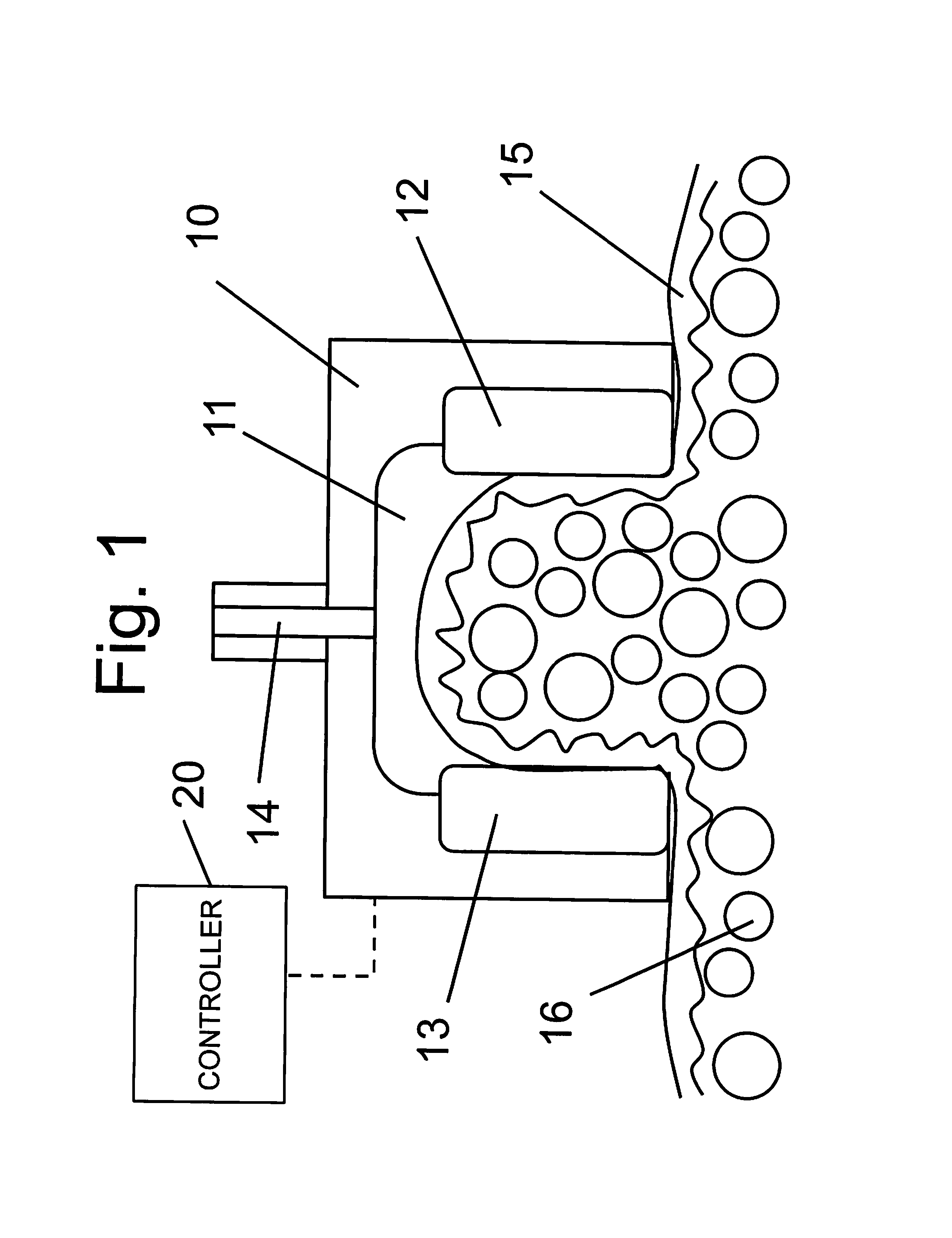 System and method for tissue treatment using non-symmetric radio-frequency energy waveform