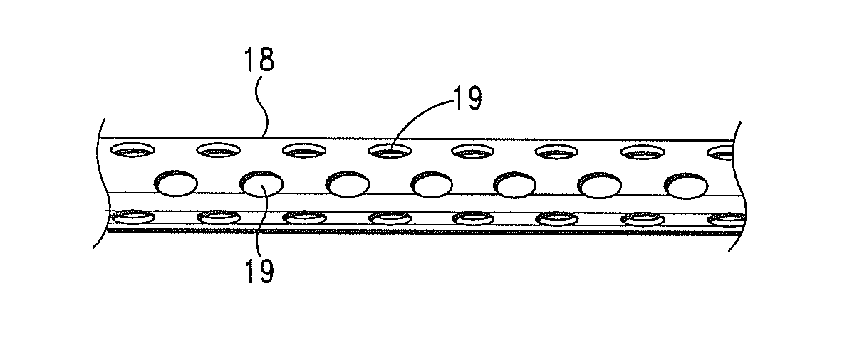 Intra-Myocardial Agent Delivery Device, System and Method