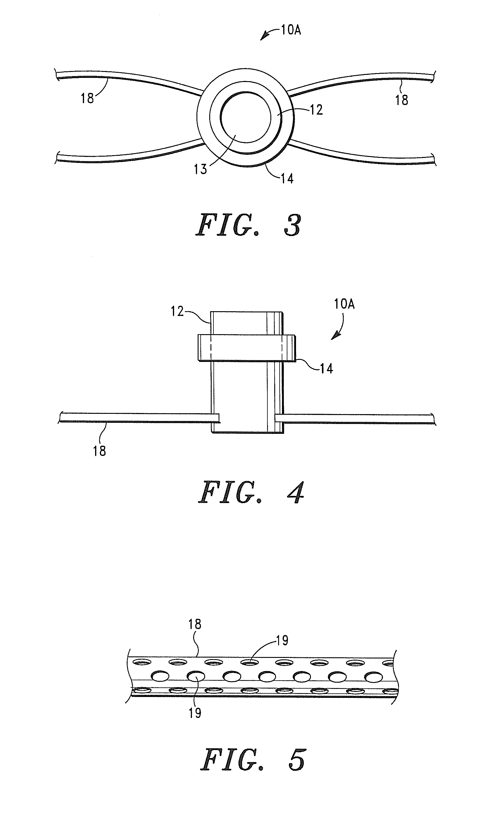 Intra-Myocardial Agent Delivery Device, System and Method