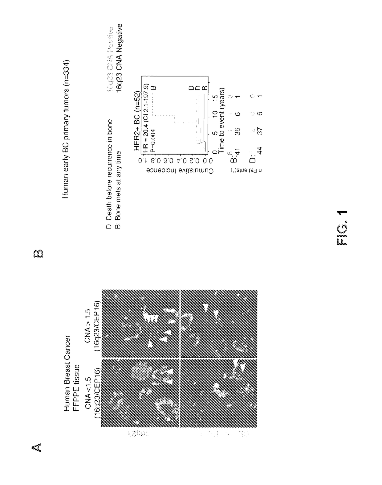 Method for the Prognosis and Treatment of Cancer Metastasis