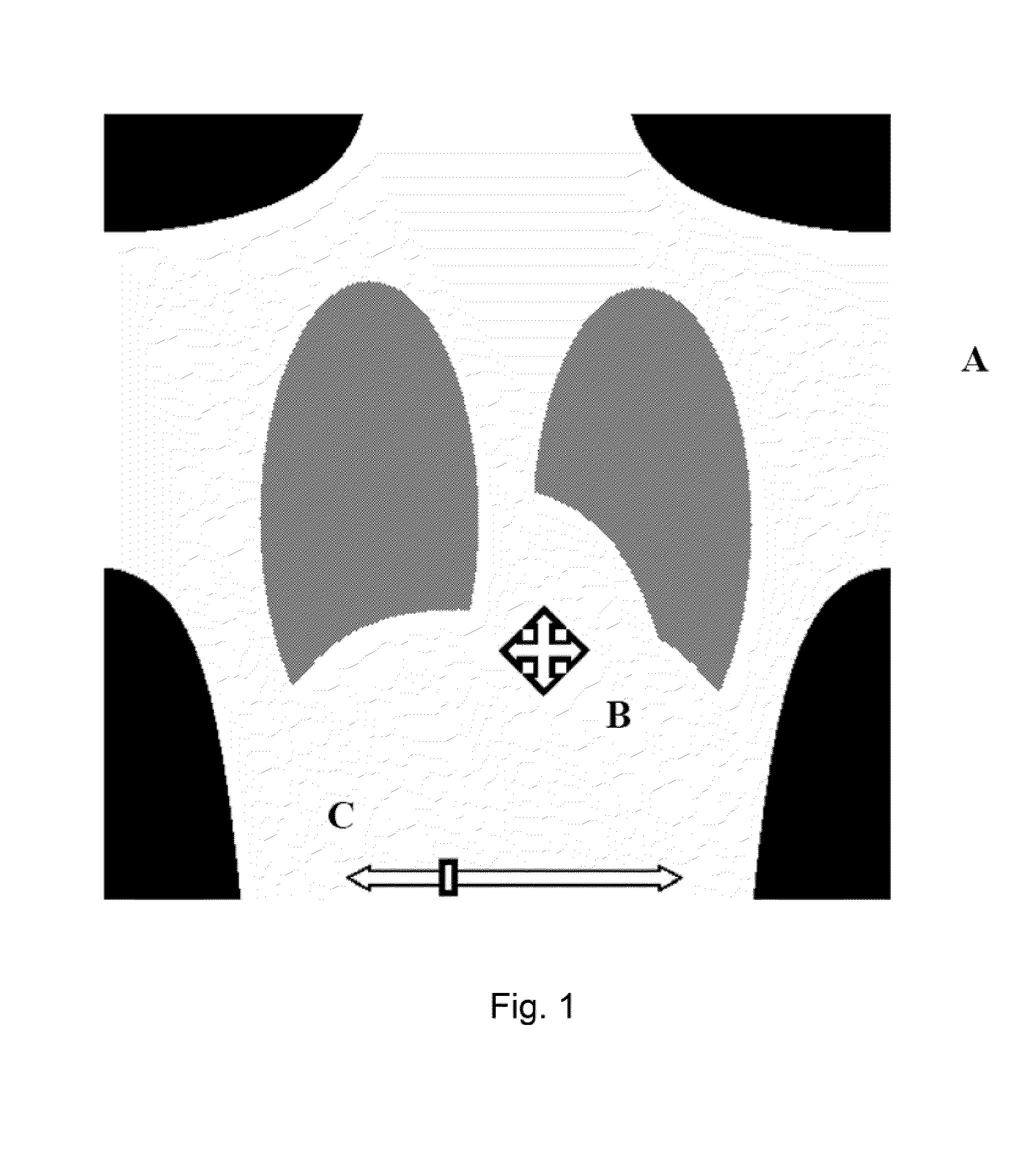 Method and System for Changing Image Density and Contrast